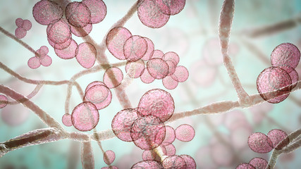 Candidiasis